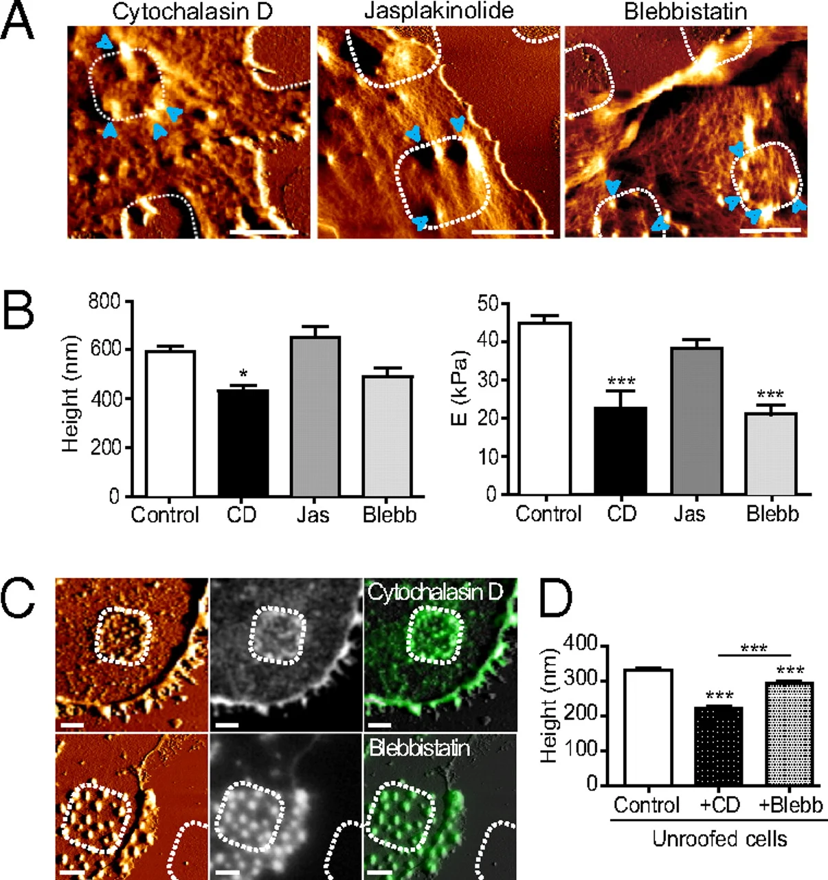 Phagocytic_Podosomes_3